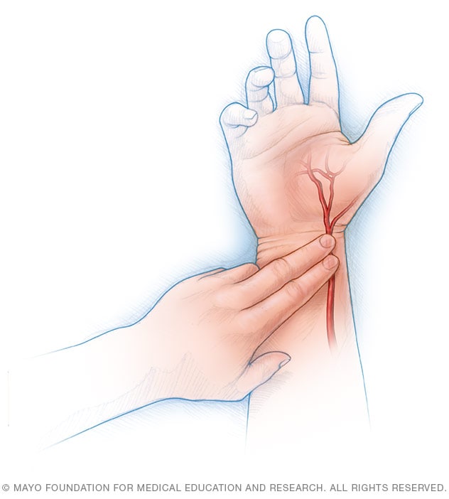 Cómo tomarte el pulso con la arteria radial