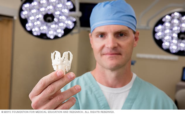 جراح يحمل نموذج حنجرة مطبوعًا بالتقنية ثلاثية الأبعاد في غرفة العمليات.