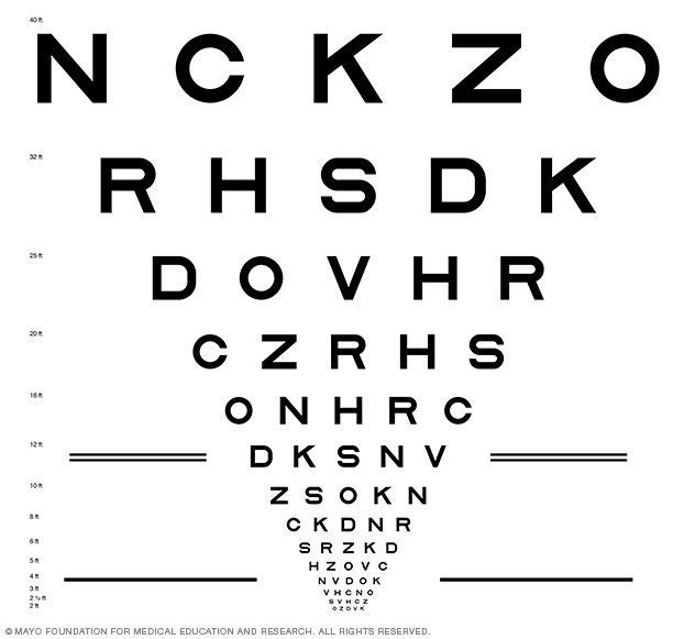 Eye Care Procedure