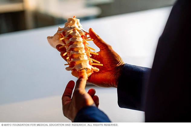 A doctor studies a 3D model of a patient’s spine.