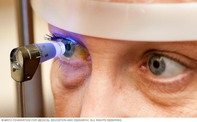 مريض يخضع لفحص العين في مجموعة تخصص المياه الزرقاء لدى مايو كلينك.