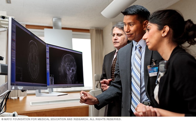 Specialists collaborate at Mayo Clinic’s Neuro-ophthalmology Specialty Group.