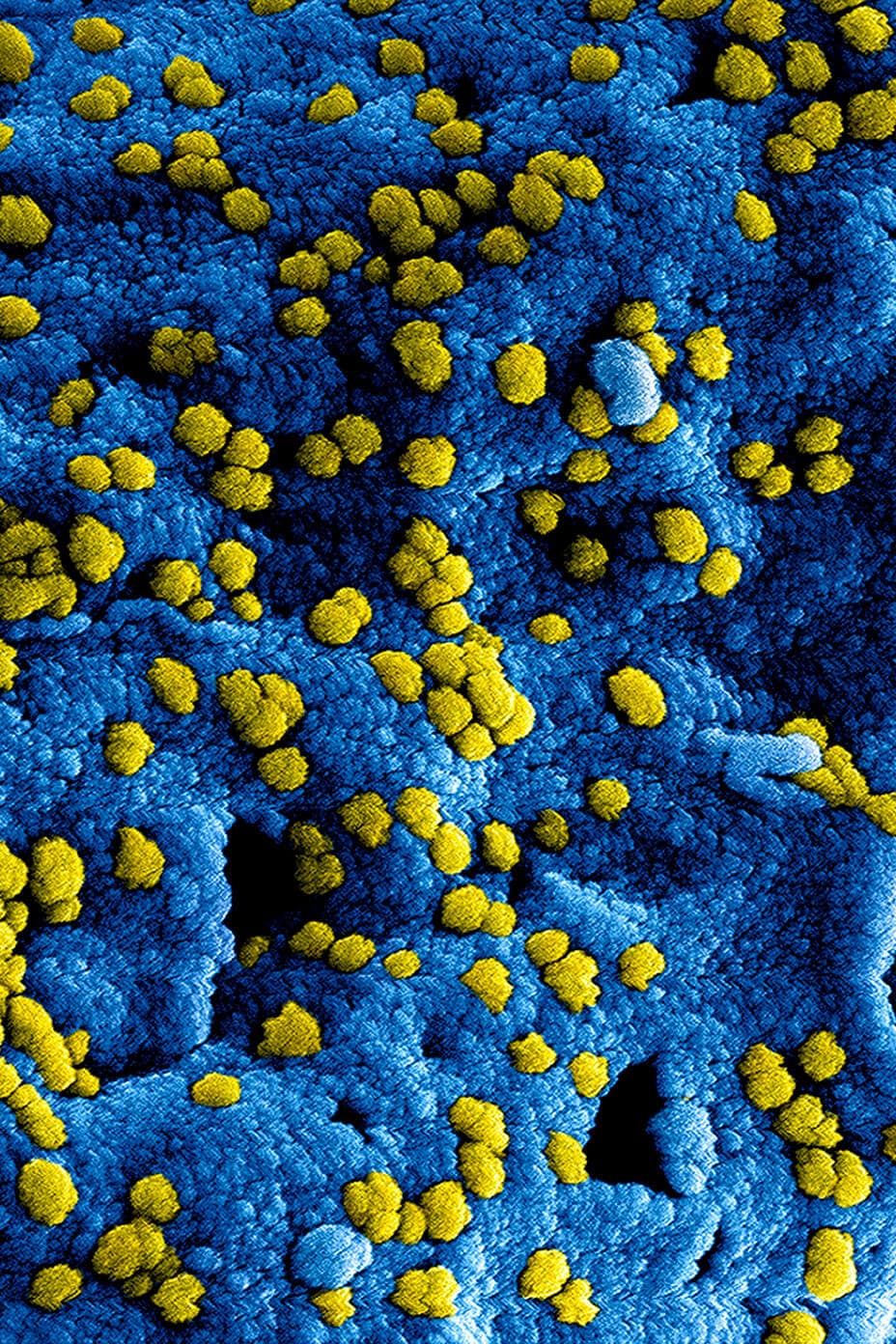 فيروس المتلازمة التنفسية الحادة الوخيمة كورونا (SARS-CoV)