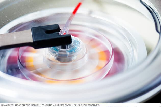 A centrifuge in motion processing platelet-rich plasma