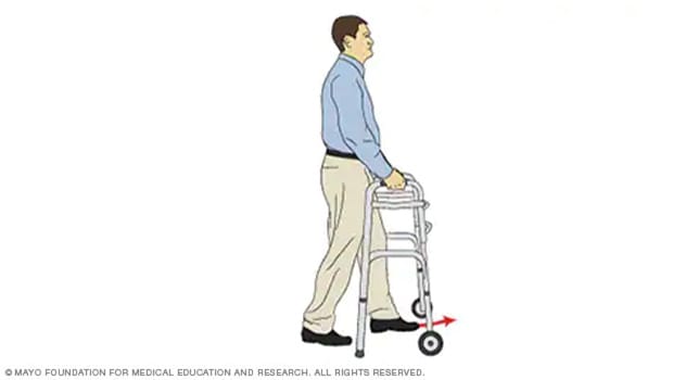 Illustration of a person stepping one foot into a walker