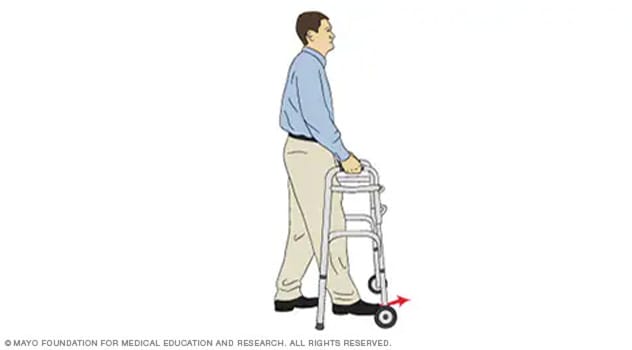 Illustration of a person moving forward with a walker