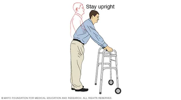 Ilustración de una persona usando un andador incorrectamente
