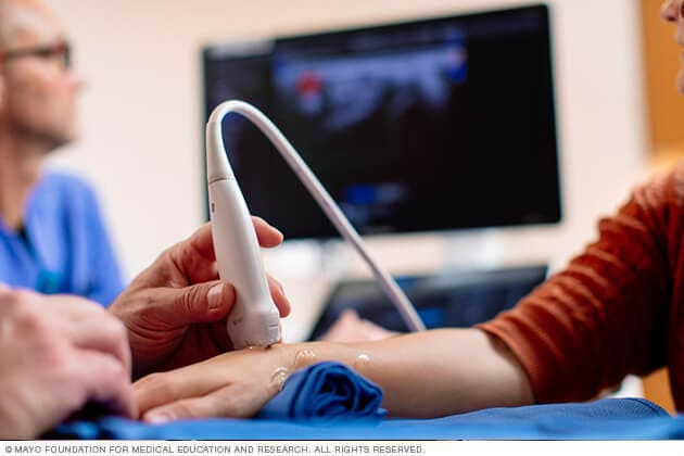 An ultrasound wand is moved over a person's hand to guide an injection.
