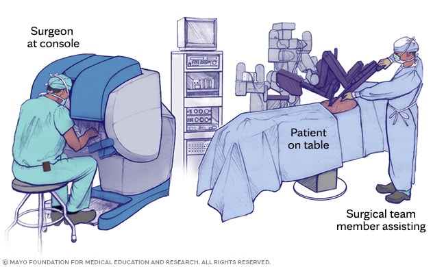 A surgeon sits at a remote console and conducts robot-assisted surgery. A surgical team member helps at the operating table.