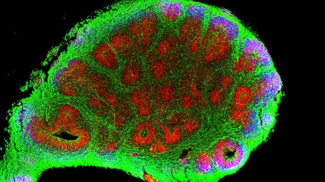 Microscopy showing immunofluorescent labeling of a cerebral organoid derived from human induced pluripotent stem cells (iPSCs)