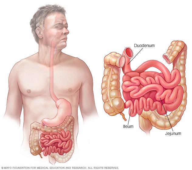 الأمعاء الدقيقة Mayo Clinic مايو كلينك