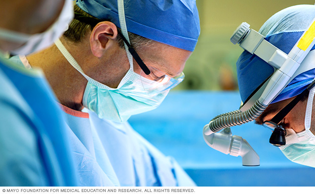 يقوم جراحو الجهاز البولي في Mayo (مايو) بإجراء استئصال الكلية الجزئي.