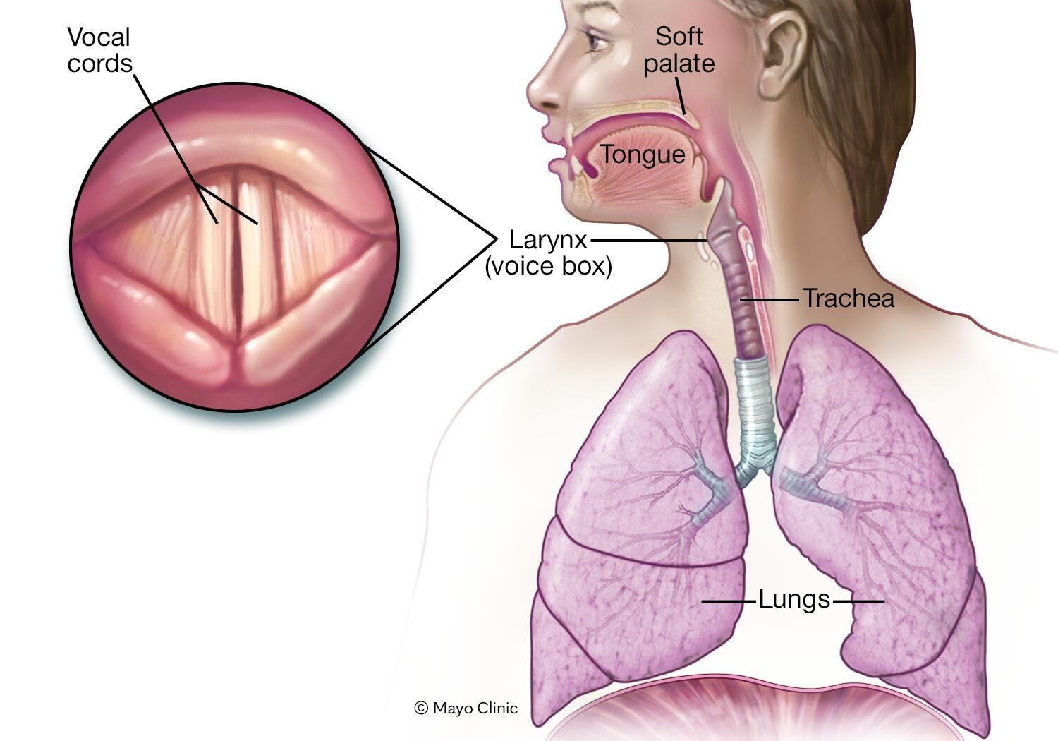 Laryngitis - Symptoms & causes - Mayo Clinic
