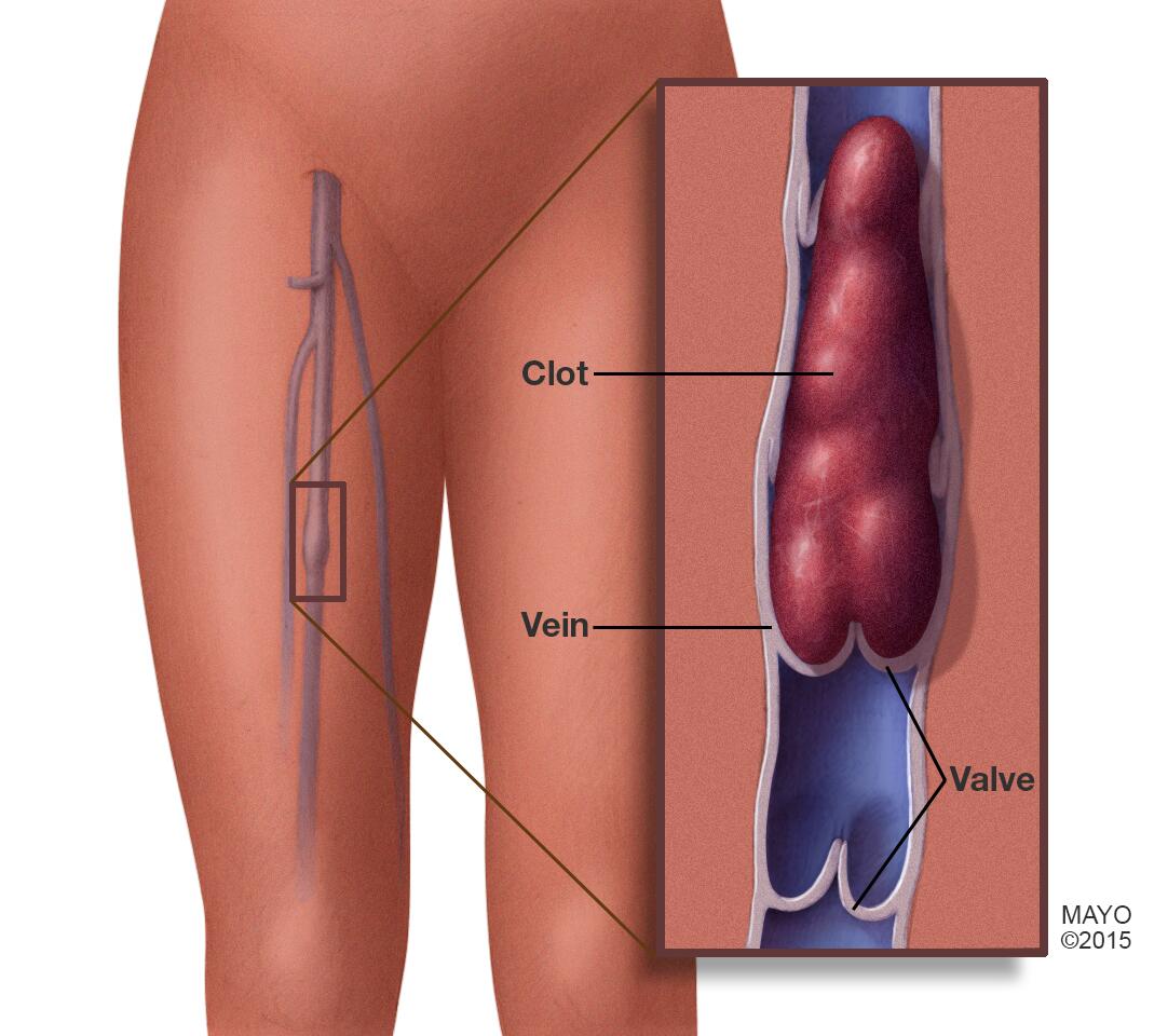 Overview of the processed model of the left leg and position of