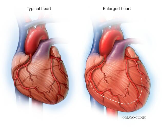 Can heart attack damage be reversed? • MyHeart