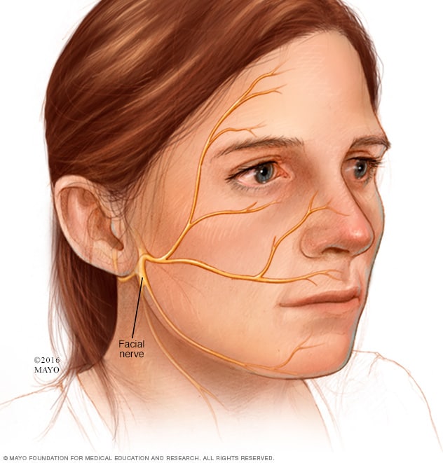 Ramsay Hunt syndrome - Symptoms & causes - Mayo Clinic