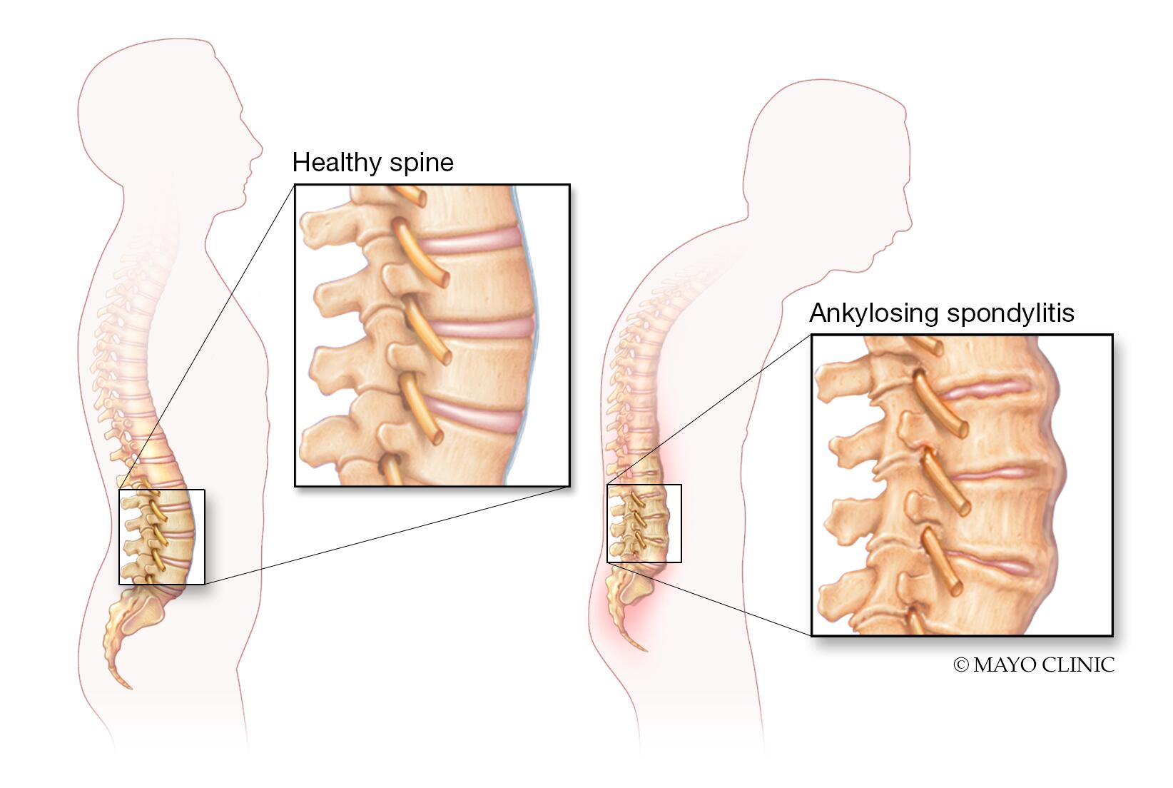 Lower Back (Human Anatomy): Image, Function, Diseases, and Treatments