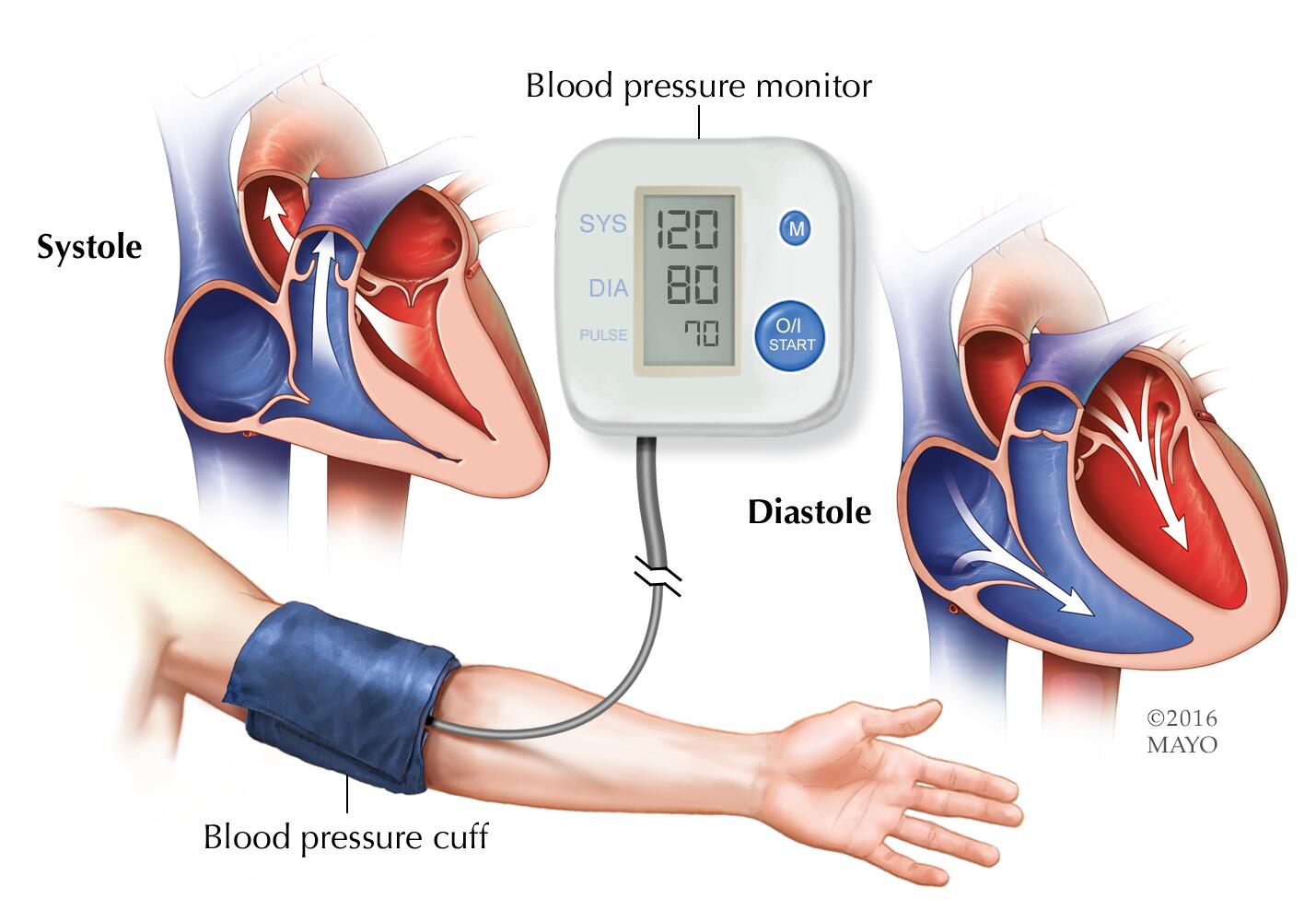 Blood pressure: Taking your child's blood pressure at home