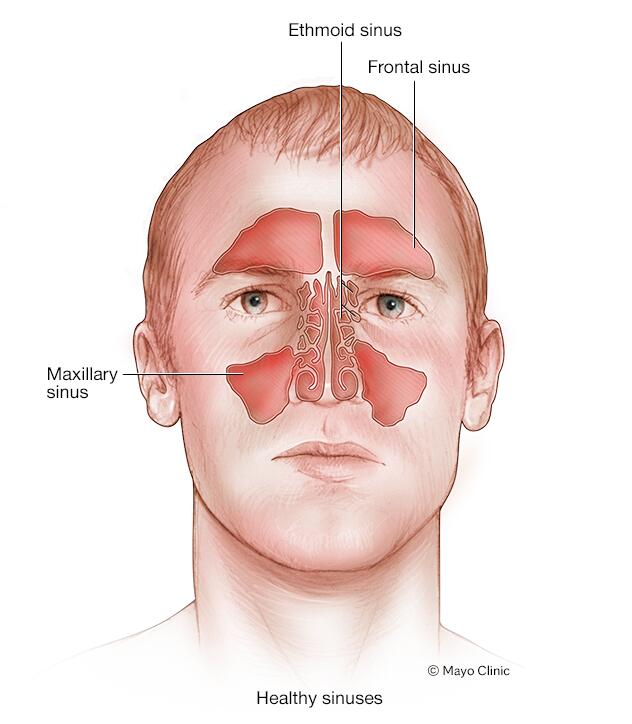 Symptoms of allergic rhinitis Clear, watery nasal discharge