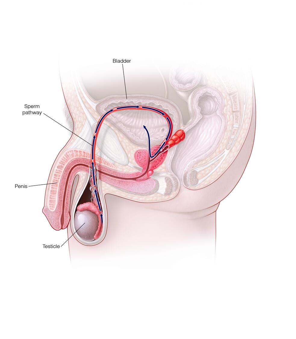 Retrograde ejaculation - Symptoms and causes photo