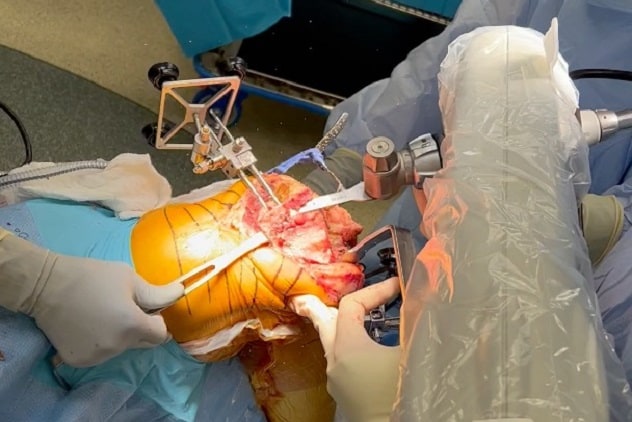 الجراحة الروبوتية لرأب مفصل الركبة بالكامل