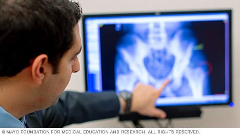 An orthopedic surgeon refers to an online pelvic scan.